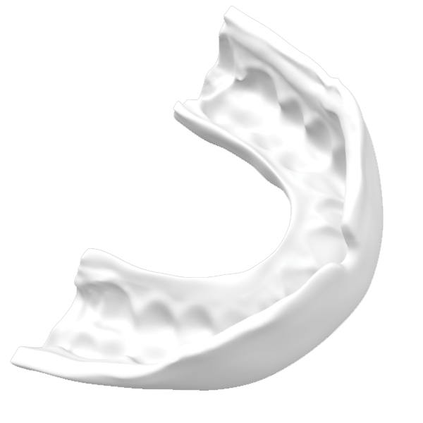 3d Printed Mouthguards - Damage Control Mouthguards